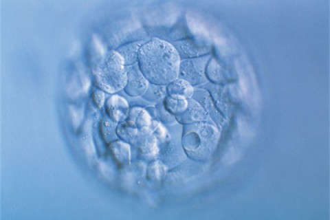 http://fuzhou.quanwangkm.com/post/190.html|福州人工试管